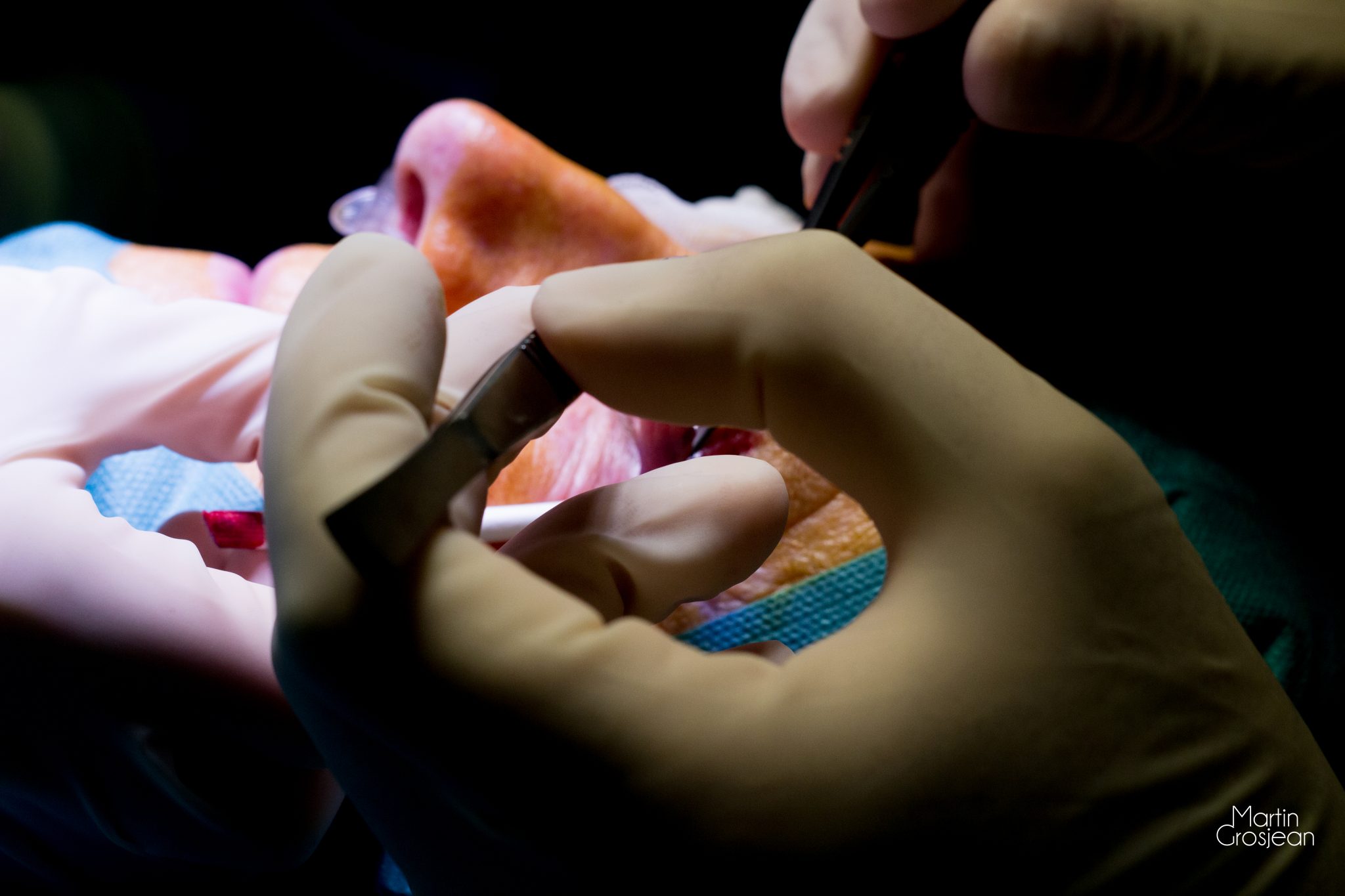 Photo-reportage pour le Dr Carlo Mannone. 
Ophtalmologue.
Lyon 2017